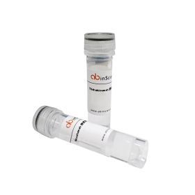 Антитела Anti-Human EGFR/ERBB1/HER1 (E7.6.3), PE, 100 тестов, abinScience