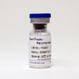 Интерлейкин-2 человеческий, рекомбинантный, (IL2), 1 мг, EastMab