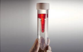 Фильтры центрифужные, 50 мл, 100 кД, белые, Jet Biofil Фильтры центрифужные, 50 мл, 100 кД, белые, Jet Biofil