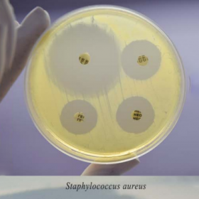 Питательная среда для определения чувствительности микроорганизмов к антибиотикам